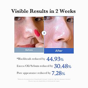 medicube Toner Pad2.0 | DualTextured Facial Pad for Evsxfoliation and AHA Lactic Acid, 0.45% BHA Salicylic Acid | Ideal for All, Korean Skin Care, 70 Pads (1 Pack) $18.9